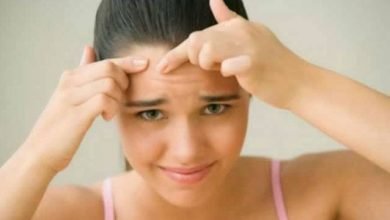 easy home remedies for pimples
